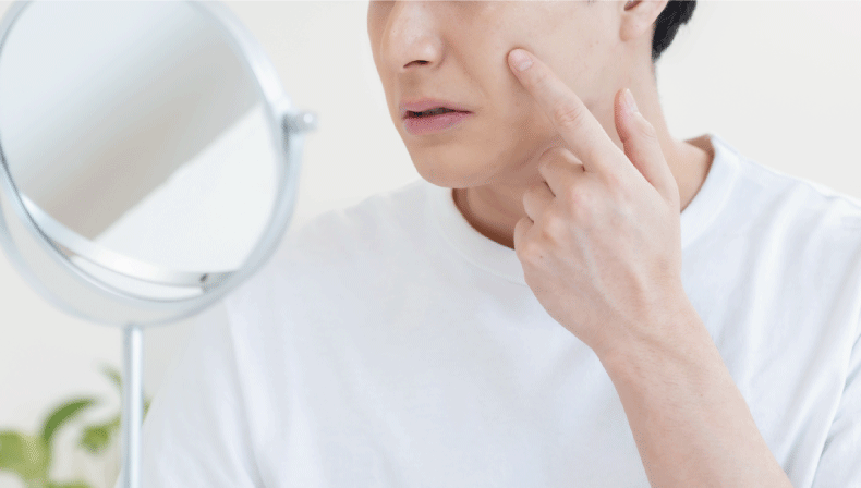 鏡を見ながらニキビを指さしている男性