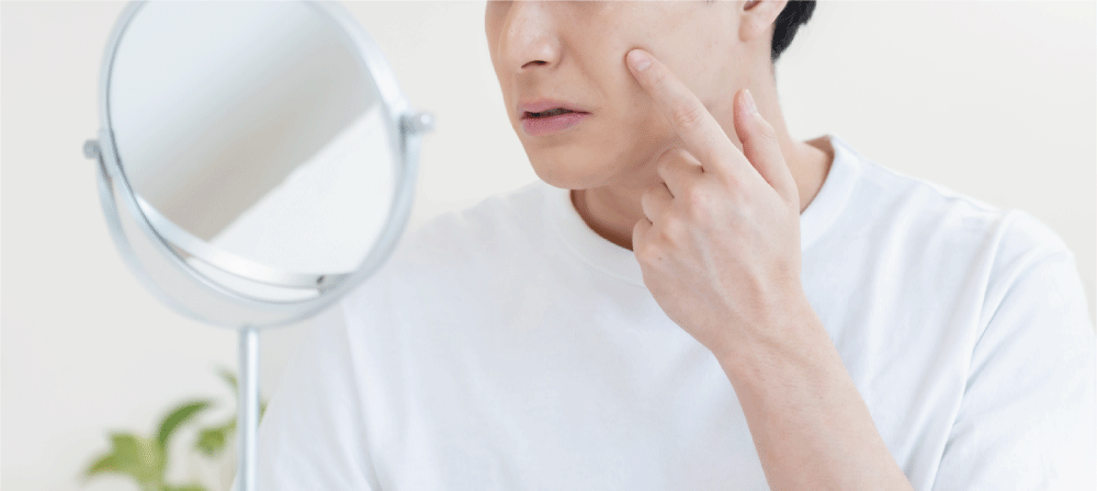 ニキビに悩むメンズ必見！繰り返すニキビの仕組みと改善法とは？