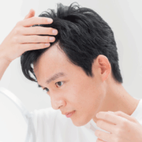 生え際を気にしている男性