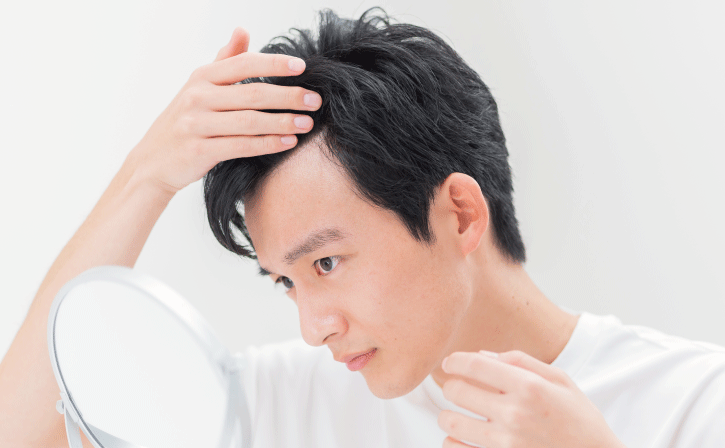 生え際を気にしている男性