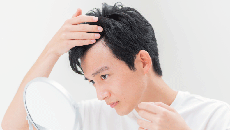 生え際を気にしている男性